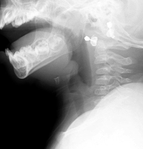 Airway Management Workshop